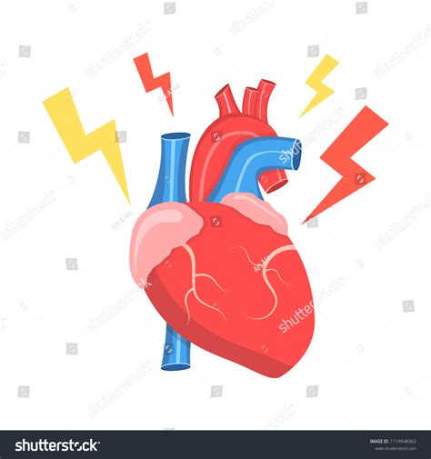 2.578 Cholesterol hypertension heart disease Bilder, Stockfotos und Vektorgrafiken | Shutterstock