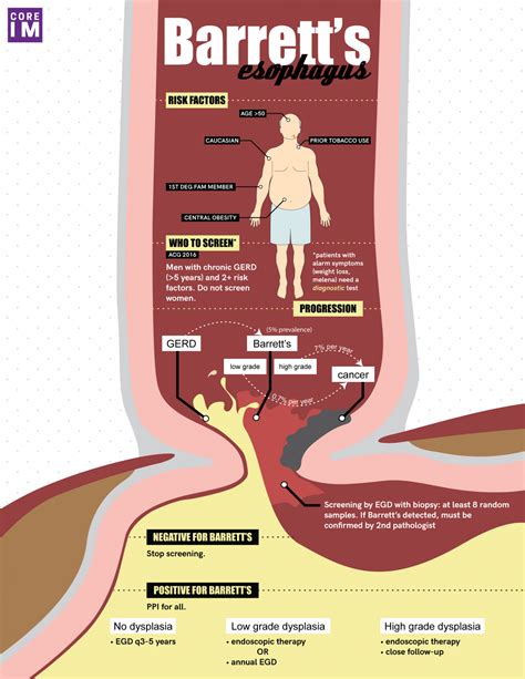 5 Pearls on Barrett's Esophagus | Core IM Podcast