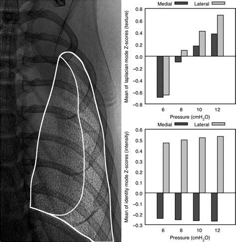Intensity Contrast 的图像结果
