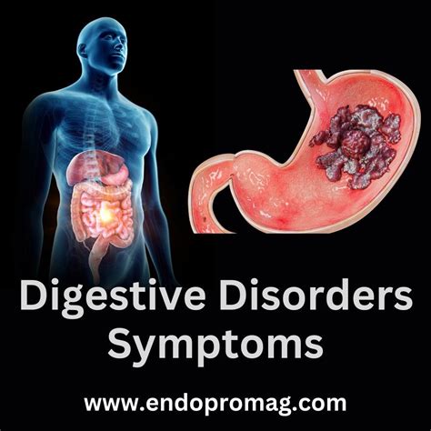 Common Digestive Disorders 的图像结果