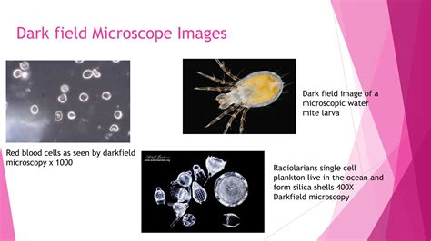 Bright field microscope and dark field microscope.pdf