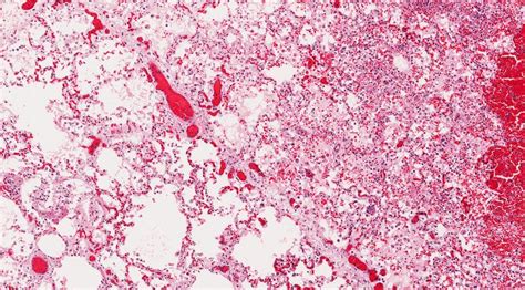 Image result for Sample Parallel Test Image