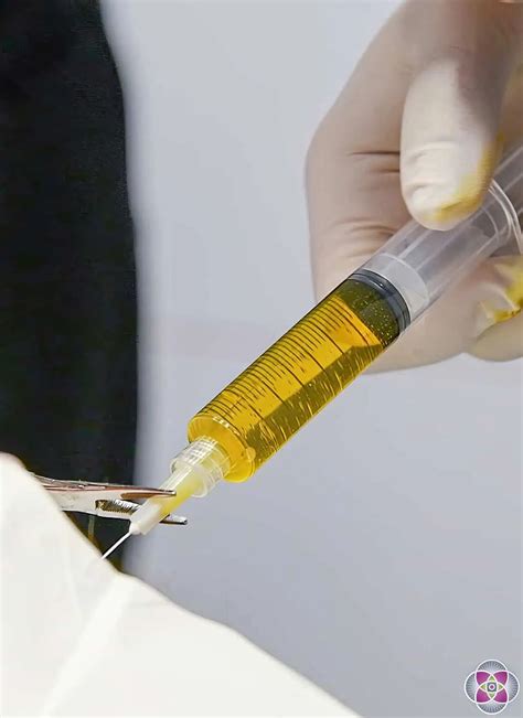 Benefits of Ozone Therapy - AMA Regenerative Medicine & Skincare