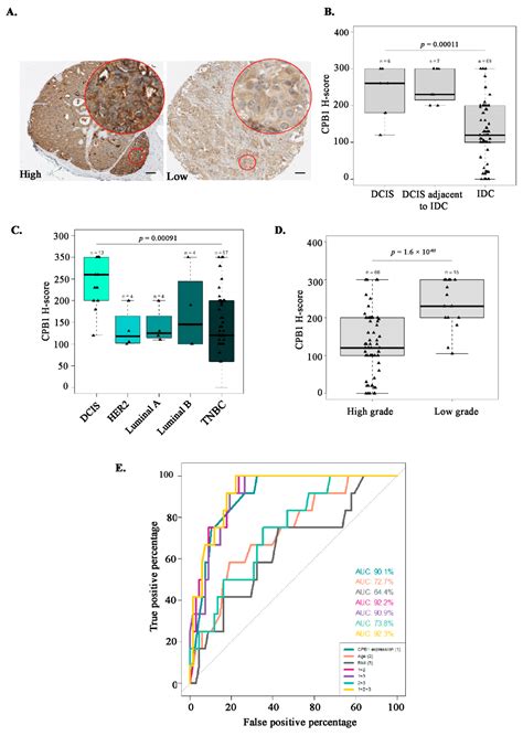 Is Carboxypeptidase B1 a Prognostic Marker for Ductal Carcinoma In Situ?