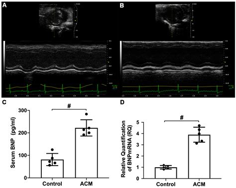 A Pilot Metabolomic Study on Myocardial Injury Caused by Chronic ...