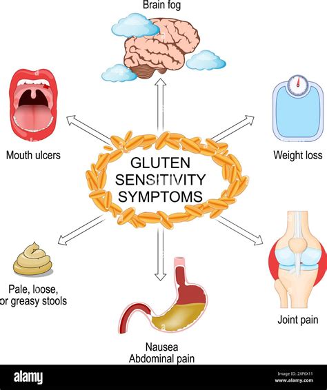 Gluten sensitivity symptoms. Gluten intolerance. Celiac disease. infographics. Vector ...