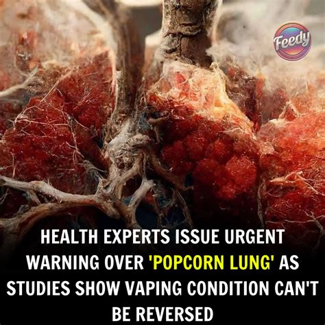 The Hidden Dangers of Vaping: Why “Popcorn Lung” Is a Serious Concern