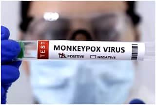 Monkeypox In Pakistan : Latest News, Videos and Photos on Monkeypox In ...