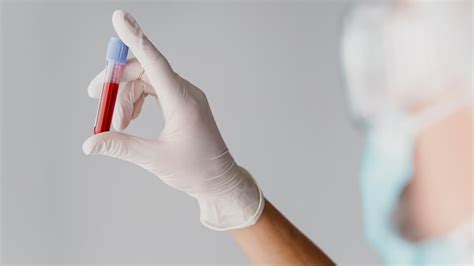 Difference Between Dengue And Typhoid Amid Risk Of Co-Infection ...