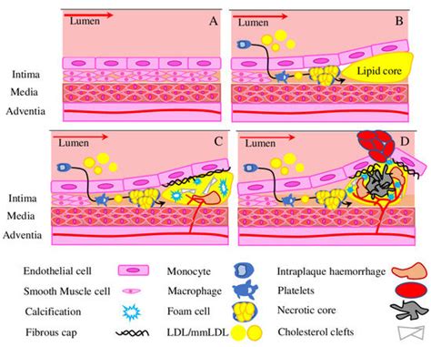 Molecular Mechanisms Underlying Pathological and Therapeutic Roles of ...