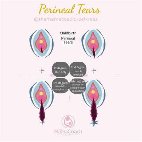 3rd and 4th Degree Tear Recovery: My Story + Tips - The Mama Coach - Kari Kress