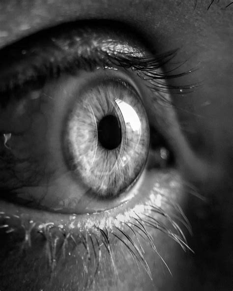 Choroidal Nevus: Understanding Your Eye's Hidden Birthmarks - Specialty Vision