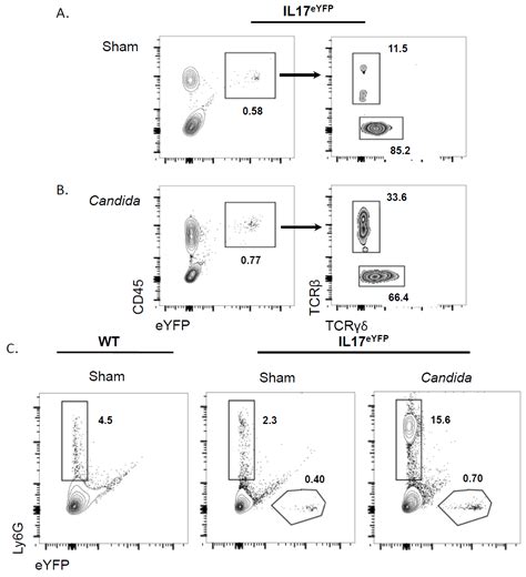 Neutrophils Do Not Express IL-17A in the Context of Acute Oropharyngeal ...