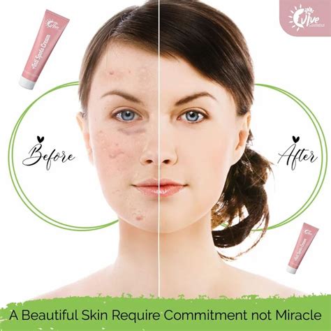 Skin Care Creams Third Party Manufacturer - Party Glow Face Cream ...