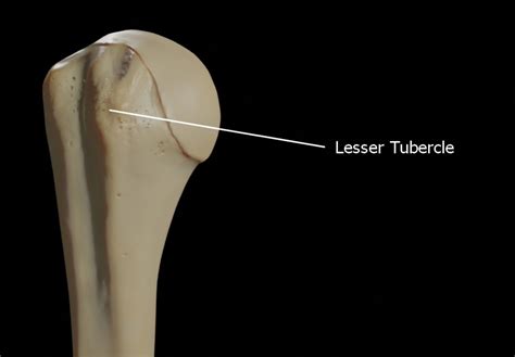 Lesser Tubercle of the Right Humerus: Anatomy and Clinical Significance ...