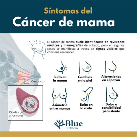 Sintomas De Cancer De Mama