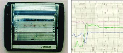 Calibrate Pneumatic Controller 的图像结果