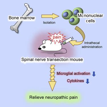 Image result for Intrathecal Injection Mouse