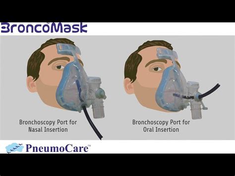 Cpap And Bipap Masks - Bronchoscopy NIV Mask Retail Trader from New Delhi