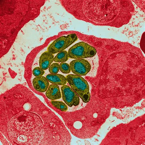 Is chloroquine resistance known in India? | Dr. Sunil Gupta