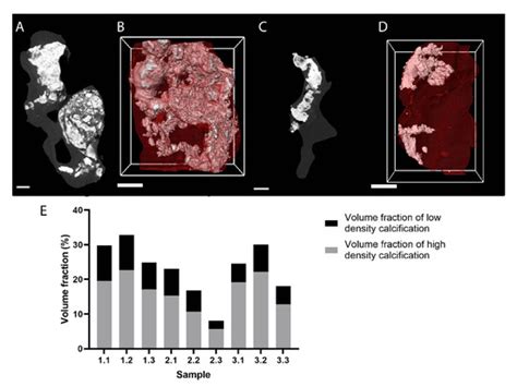 A Review of Ex Vivo X-ray Microfocus Computed Tomography-Based ...