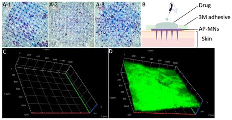 Preparation and Evaluation of Auxiliary Permeable Microneedle Patch ...