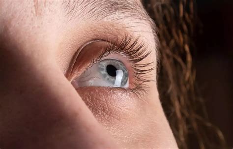 New genetic eye disease discovered by NIH researchers