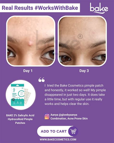 2% Salicylic Acid Pimple Patches with Hydrocolloid Waterproof Patches