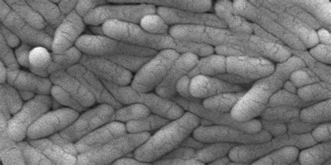 New salmonella outbreak is linked to backyard poultry, CDC says