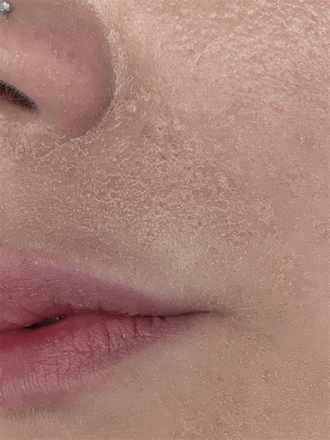 does anyone know what causes makeup to do this??? i have tried different products, primers ...