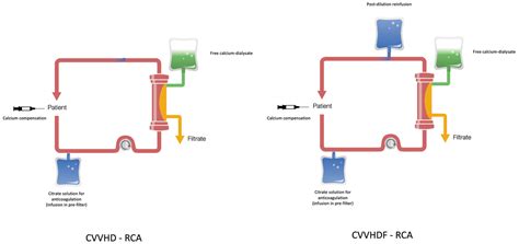 Safety of Citrate Anticoagulation in CKRT: Monocentric Experience of a ...