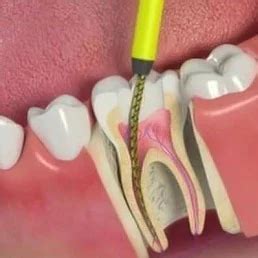 Pearl Dental Care