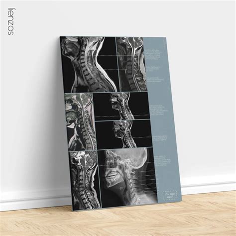 Patología Cervical » educare.design