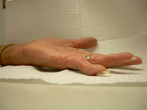 Image result for Hand Dysfunction