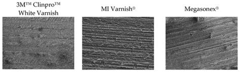 The Effects of Three Remineralizing Agents on the Microhardness and ...