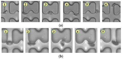 Diseased Erythrocyte Enrichment Based on I-Shaped Pillar DLD Arrays
