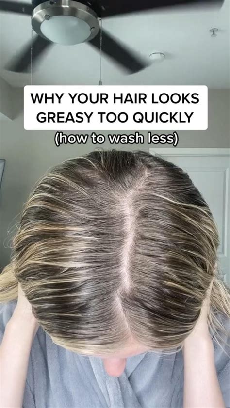 How To Get Rid Of Greasy Hair On Top Of Head at Charlie Lowe blog