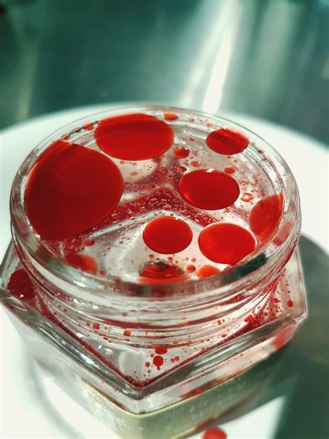 LDL Cholesterol: Importance, Normal Ranges & Management – MyDiagnostics