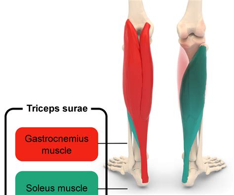 Soleus Muscle Strain