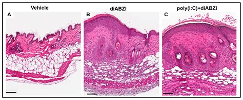 STING Agonist-Induced Skin Inflammation Is Exacerbated with Prior ...