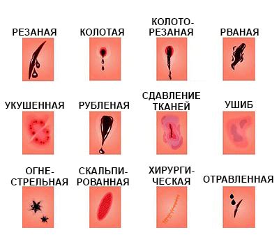 Открытая рана. НДЦ Королев