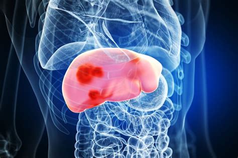 Disease Health Packages
