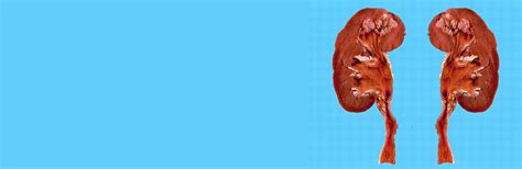 Tuberculosis and the Kidney | Medtalks