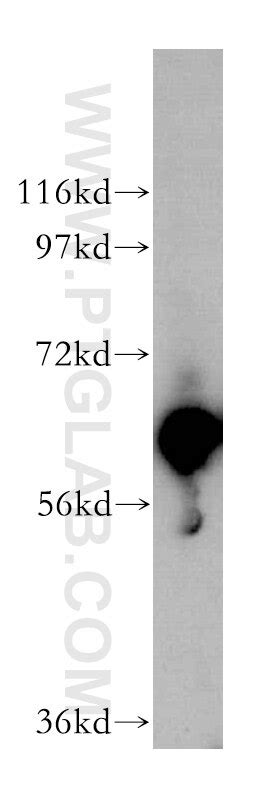GAL3ST4 antibody (16240-1-AP) | Proteintech
