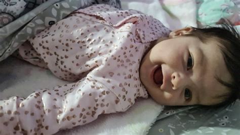 Apendice preauricular | BabyCenter