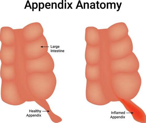 Image result for Appendix Example Website