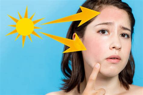 5,900+ Sunburn Face Stock Photos, Pictures & Royalty-Free Images - iStock