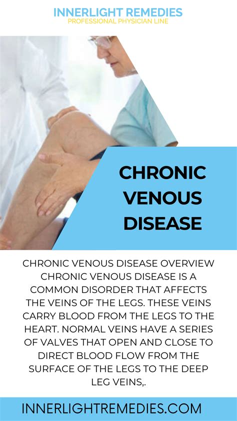 Best Supplements To Boost Circulation And Help Venous Insufficiency</Think>Natural Remedies For Venous Insufficiency: What Actually Works