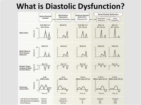 Image result for Moderate Diastolic Dysfunction