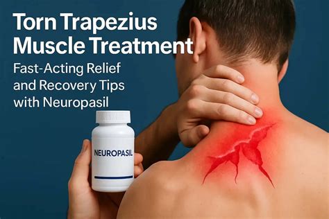 Torn Trapezius Muscle Treatment: Fast-Acting Relief and Recovery Tips ...
